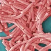 Two Legionnaires’ Disease Cases at Staten Island’s Castleton Park Apartments Trigger a City Investigation Into the Building’s Hot Water System and Resident Guidance Apartment buildings at Castleton Park on Staten Island under city health investigation